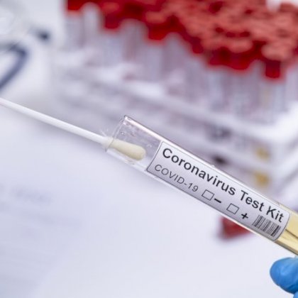 COVID-19 Screening Test kits